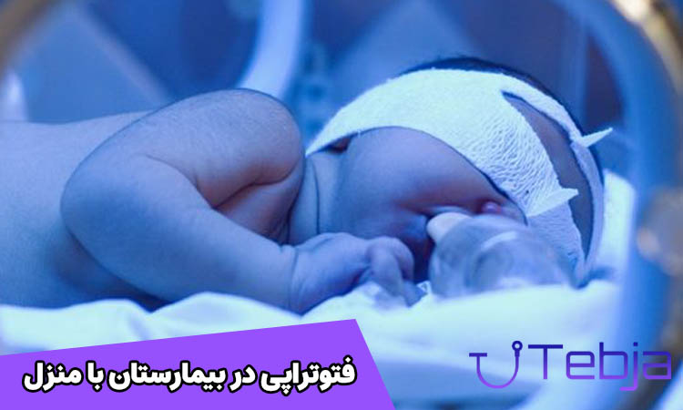 مقایسه فتوتراپی در بیمارستان با منزل