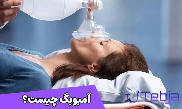 آمبوبگ چیست
