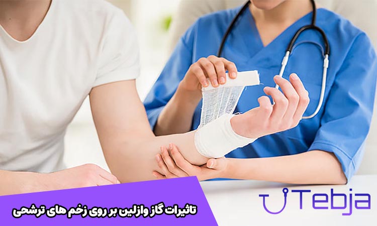 تاثیرات گاز وازلین روی زخم های ترشحی