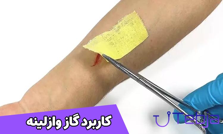 کاربرد گاز وازلینه