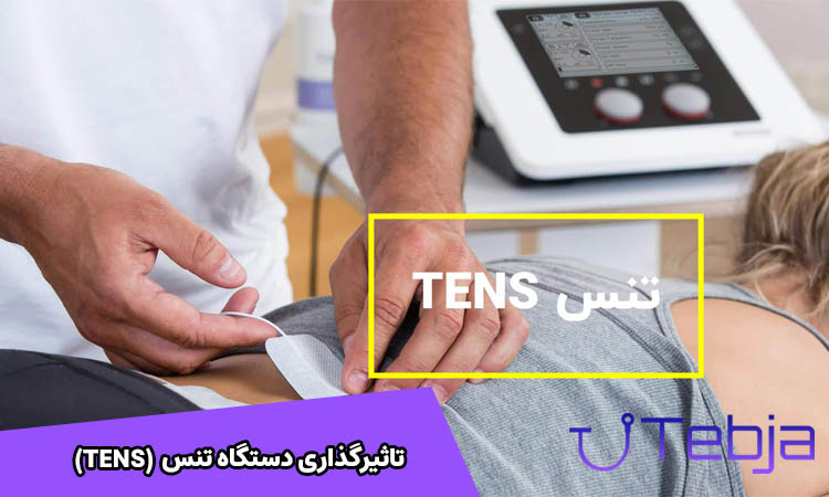 تاثیرگذاری دستگاه تنس