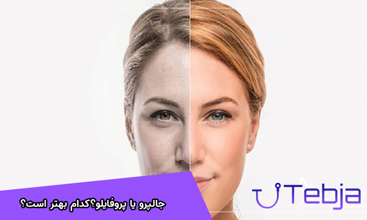 جالپرو یا پروفایلو